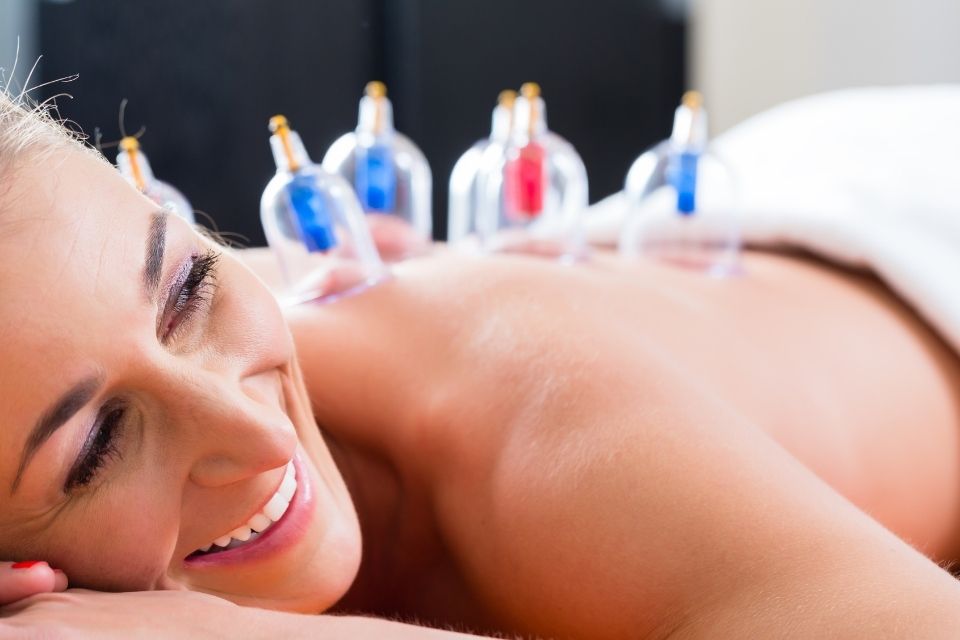 cupping aki acupunctuur den haag