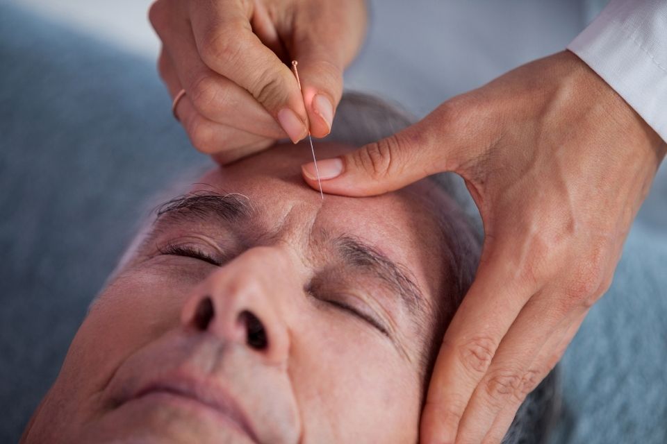 waarvoor acupunctuur aki den haag waarvoor acupunctuur aki den haag