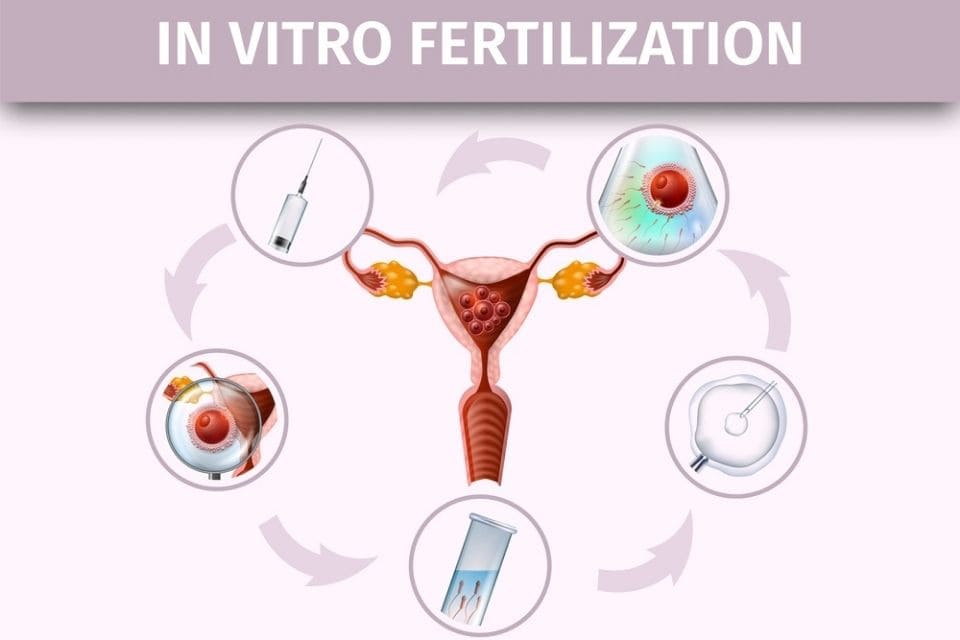 acupunctuur vruchtbaarheid ivf icsi iui