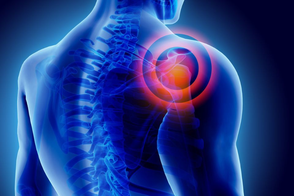 frozen shoulder acupunctuur