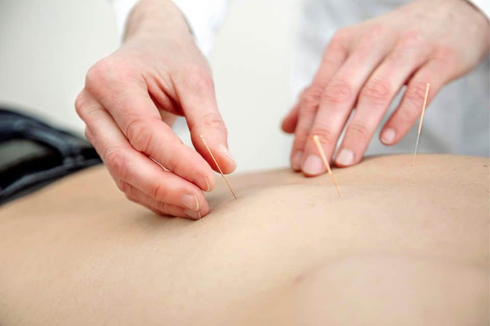 acupuncturist mandy hopman aki